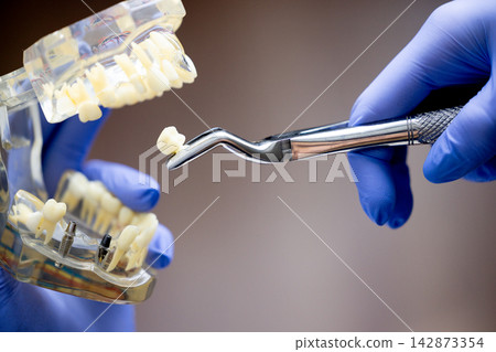 Dental spoon held by dentist over transparent jaw typodont for clinical procedure Dental spoon held by dentist over transparent jaw typodont for clinical procedure 142873354