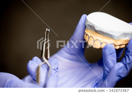 Orthodontic bracket placement on upper jaw plaster model with tweezers Orthodontic bracket placement on upper jaw plaster model with tweezers 142873367