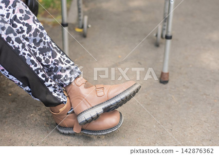 A Caucasian woman with cerebral palsy sits on a park bench. Close-up of her legs. 142876362