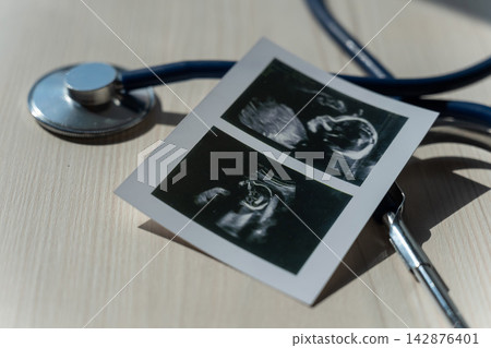 Photo: Ultrasound screening of a child and stethoscope. Image of an embryo. Photo: Ultrasound screening of a child and stethoscope. Image of an embryo. 142876401