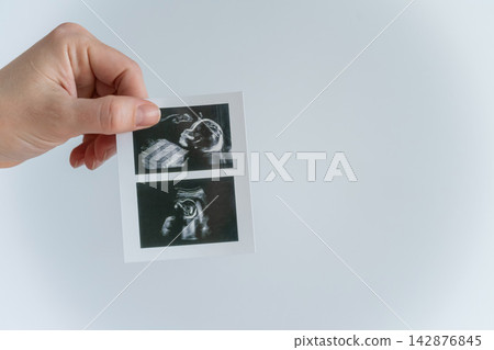 Woman holding a photo of an ultrasound scan of a baby on a white background.  142876845