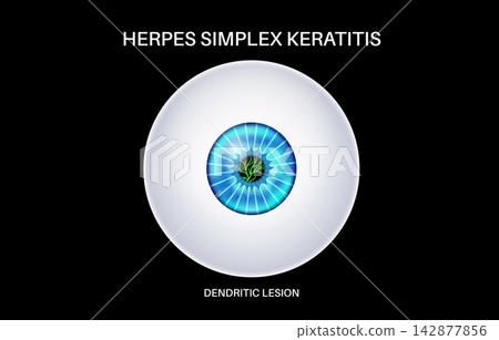 Frontal view blue iris layout Frontal view blue iris layout 142877856
