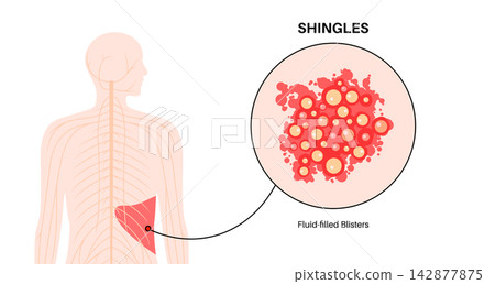 Nervous system reactivation scheme 142877875