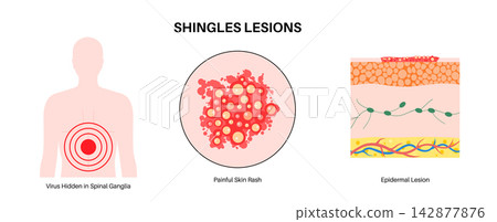 Epidermal nerve cells layout Epidermal nerve cells layout 142877876