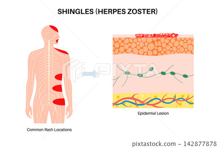 Body silhouette location diagram Body silhouette location diagram 142877878