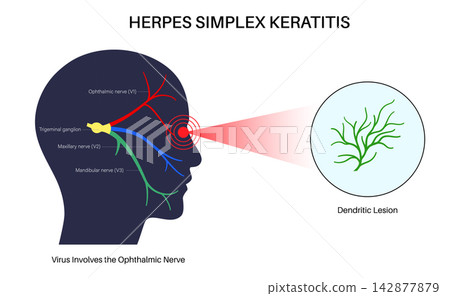 Nerve branches zoom circle 142877879