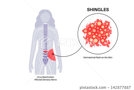 Lumbar spine nerve localization Lumbar spine nerve localization 142877887