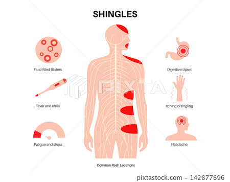 Nervous system symptoms layout Nervous system symptoms layout 142877896