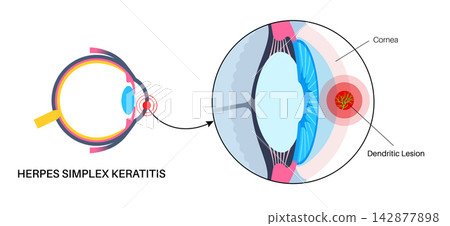 Eyeball cross section transition Eyeball cross section transition 142877898