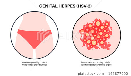 Groin skin rash symptoms 142877900