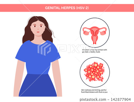 Genital herpes reproduction scheme Genital herpes reproduction scheme 142877904