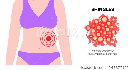 Abdominal target zone banner Abdominal target zone banner 142877905
