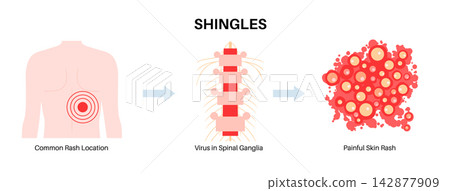 Flank rash transition stages Flank rash transition stages 142877909