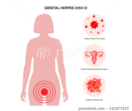 Groin focus diagnostic icons Groin focus diagnostic icons 142877935