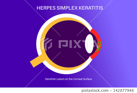 Minimal gradient corneal poster 142877948