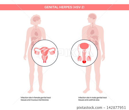 Infection site comparison layout Infection site comparison layout 142877951