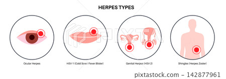 Virus types differentiation infographic Virus types differentiation infographic 142877961