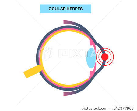 Cornea focus infographic layout 142877963