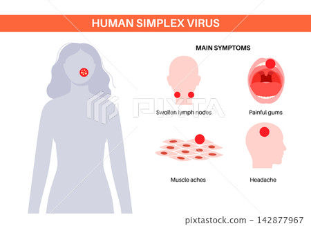 Herpes simplex virus HSV1 Herpes simplex virus HSV1 142877967