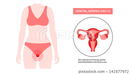 Female target infection zone Female target infection zone 142877972