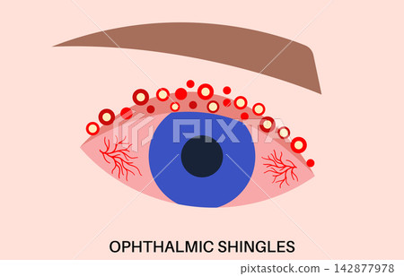 Ophthalmic shingles macro icon Ophthalmic shingles macro icon 142877978