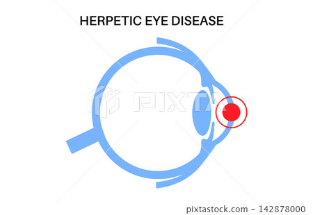 Blue line infection icon Blue line infection icon 142878000