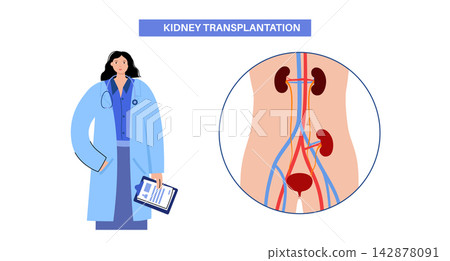 Kidney transplant surgery Kidney transplant surgery 142878091