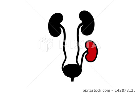 Kidney transplant surgery Kidney transplant surgery 142878123