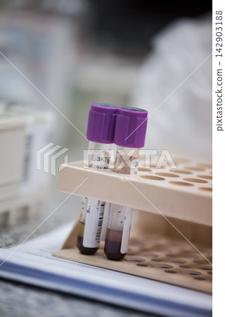 Young Middle Eastern doctors and medical technician handling blood test tubes in clinical laboratory setting Young Middle Eastern doctors and medical technician handling blood test tubes in clinical laboratory setting 142903188