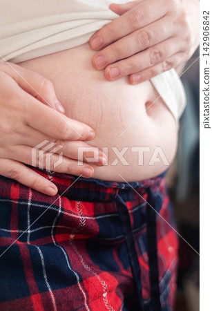 Woman touching stretch marks on belly skin. Close up of female hands holding stomach with striae after pregnancy or weight loss. Woman touching stretch marks on belly skin. Close up of female hands holding stomach with striae after pregnancy or weight loss. 142906842