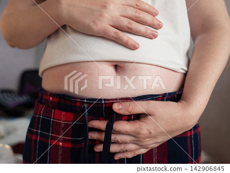 Woman touching stretch marks on belly skin. Close up of female hands holding stomach with striae after pregnancy or weight loss. Woman touching stretch marks on belly skin. Close up of female hands holding stomach with striae after pregnancy or weight loss. 142906845