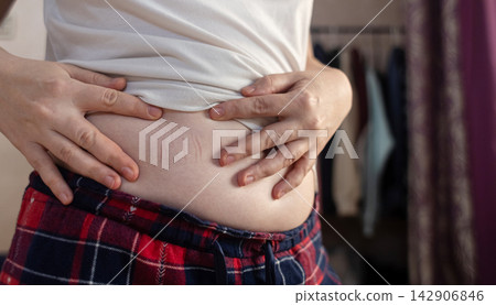 Close-up of a woman touching elastic waistband marks on her stomach skin. Tight clothing imprint caused by uncomfortable waistband and skin pressure. 142906846