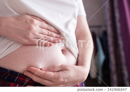 Close-up of a woman touching elastic waistband marks on her stomach skin. Tight clothing imprint caused by uncomfortable waistband and skin pressure. Close-up of a woman touching elastic waistband marks on her stomach skin. Tight clothing imprint caused by uncomfortable waistband and skin pressure. 142906847