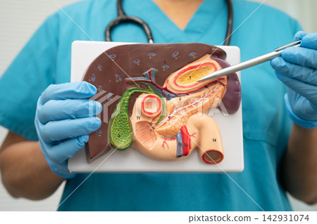 Cirrhosis, Liver cancer, fatty liver, Asian doctor with liver human anatomy model in World Hepatitis Day at hospital. 142931074