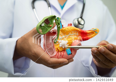 Pancreatitis, pancreatic cancer, Asian doctor with pancreas, gallbladder and bile duct human anatomy model at hospital. Pancreatitis, pancreatic cancer, Asian doctor with pancreas, gallbladder and bile duct human anatomy model at hospital. 142931649