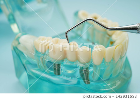 Teeth dental model with tool for dentist use to cleaning care treatment. Teeth dental model with tool for dentist use to cleaning care treatment. 142931658