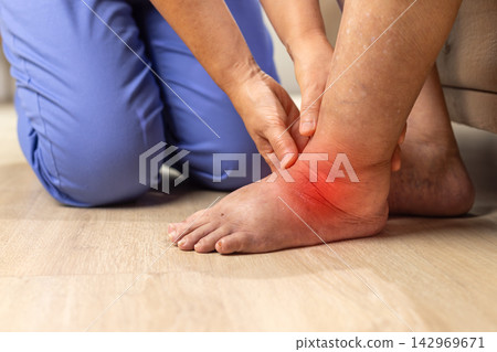 Nurse Performing Pitting Edema Test on Elderly Patient's Swollen Ankle: Geriatric Care Nurse Performing Pitting Edema Test on Elderly Patient's Swollen Ankle: Geriatric Care 142969671