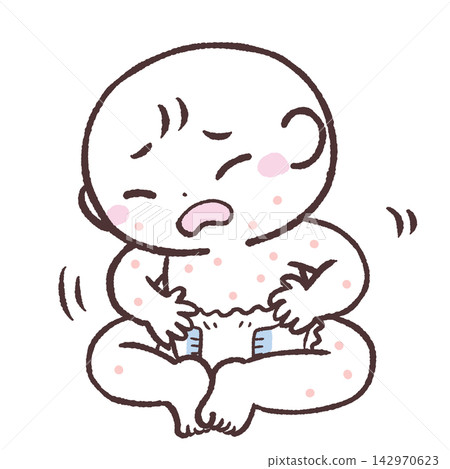 嬰兒蕁麻疹插圖 嬰兒蕁麻疹插圖 142970623