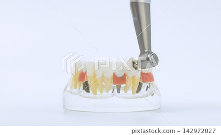 Professional oral hygiene concept showing a dental drill with polishing brush cleaning teeth on a transparent jaw model. 142972027
