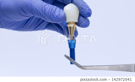 Dental implant crown and abutment connection demonstration with gloved hand assembling prosthetic tooth onto titanium implant fixture 142972041