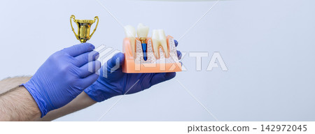 Dental implant success concept with dentist hands holding tooth model and golden trophy on copy space background Dental implant success concept with dentist hands holding tooth model and golden trophy on copy space background 142972045