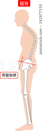姿勢不良的男性:脊椎和骨盆 姿勢不良的男性:脊椎和骨盆 142977310