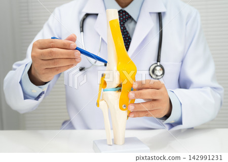 Osteoarthritis of the knee, Doctor holding human knee joint orthopedic anatomy model in hospital. Osteoarthritis of the knee, Doctor holding human knee joint orthopedic anatomy model in hospital. 142991231