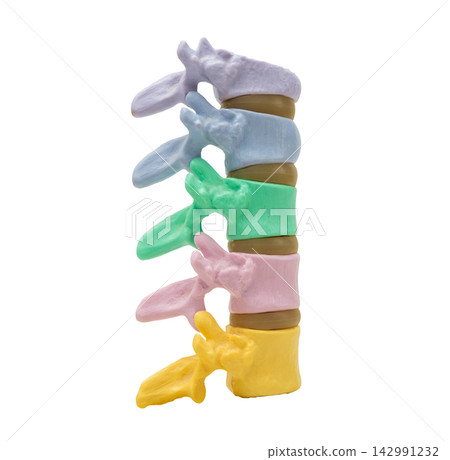osteoporosis in back bone model isolated on white background with clipping path. osteoporosis in back bone model isolated on white background with clipping path. 142991232