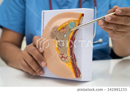 doctor holding female breast human anatomy model. doctor holding female breast human anatomy model. 142991233