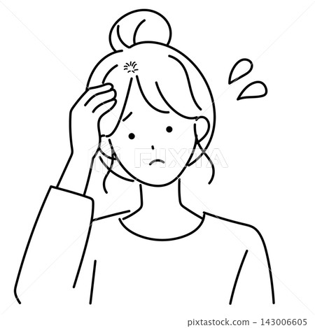 一位20多歲的年輕女性患有斑禿 一位20多歲的年輕女性患有斑禿 143006605