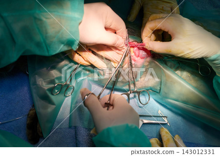 Surgeons Perform Delicate Operation With Instruments In A Sterile Operating Room Surgeons Perform Delicate Operation With Instruments In A Sterile Operating Room 143012331