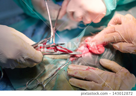 Surgeons Perform Complex Surgical Operation Using Scalpels And Forceps In Sterile Setting 143012872
