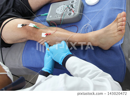 Electromyography in the lower limbs, graphic recording technique of the electrical activity produced by the tibial muscle performed by a specialist neurologist Electromyography in the lower limbs, graphic recording technique of the electrical activity produced by the tibial muscle performed by a specialist neurologist 143020472