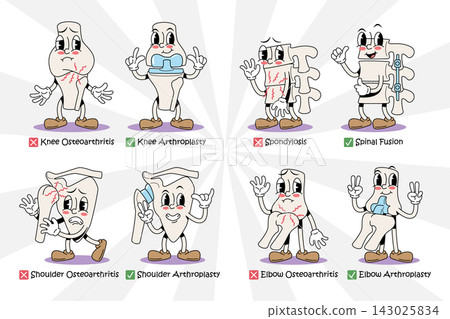 Orthopedics osteoarthritis and joint replacement arthroplasty vintage 1930s rubber hose cartoon characters set. featuring knee, spine, shoulder, elbow surgery. Vector illustration. Orthopedics osteoarthritis and joint replacement arthroplasty vintage 1930s rubber hose cartoon characters set. featuring knee, spine, shoulder, elbow surgery. Vector illustration. 143025834